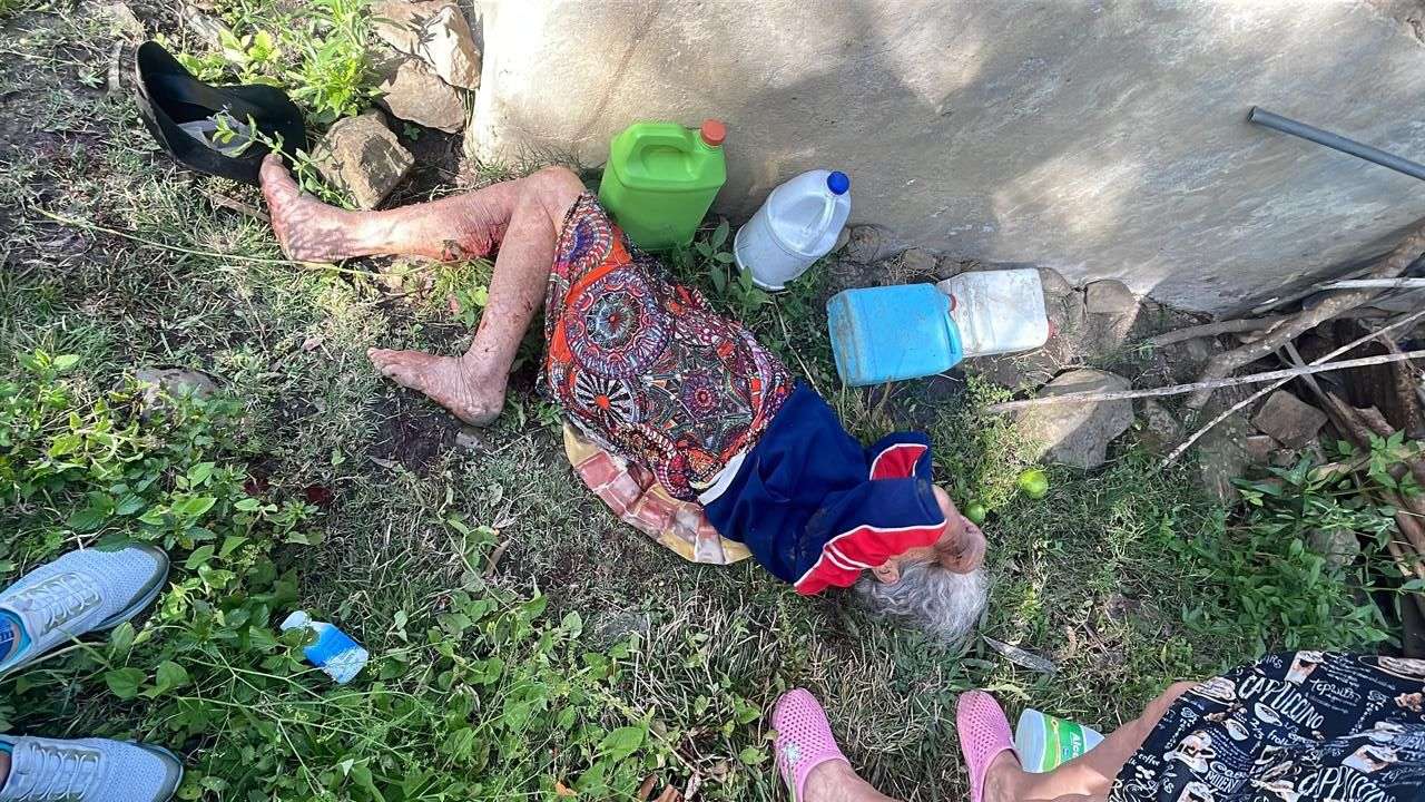 En Cáqueza, adulta mayor en abandono fue encontrada en delicado estado de salud
