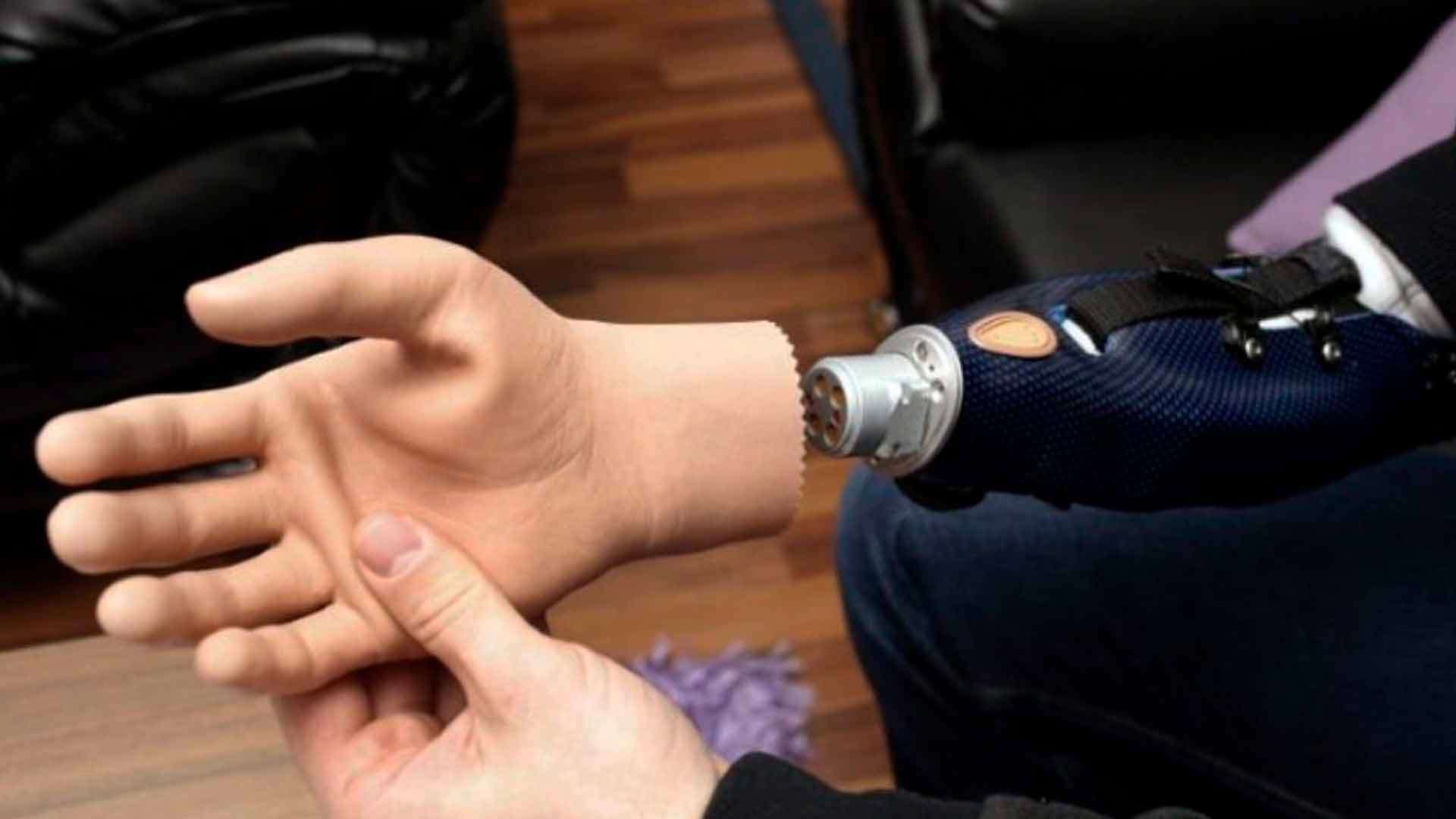 Ubalá otorga prótesis gratuitas para personas con discapacidad